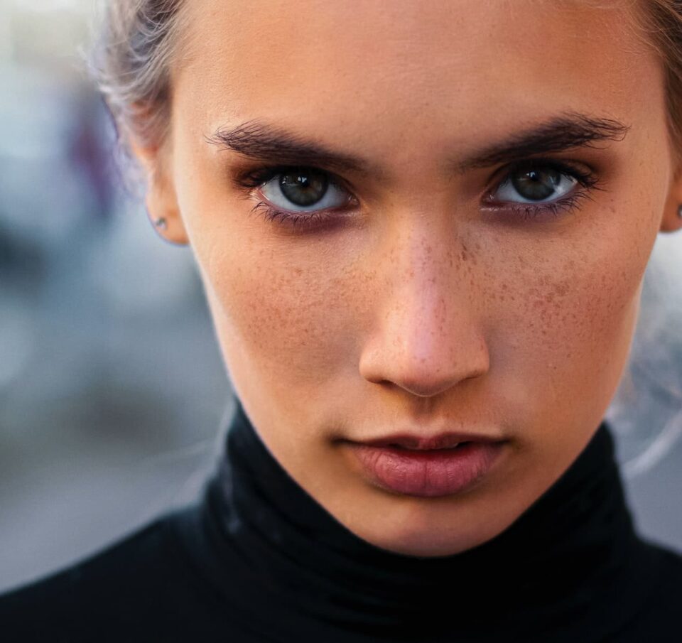 Γιατί αυξάνονται οι πωλήσεις Botox σε νεότερους