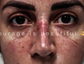 Campaign of the Day : Dove | Όταν ένα σαπούνι γίνεται σύμβολο κοινωνικής αλλαγής