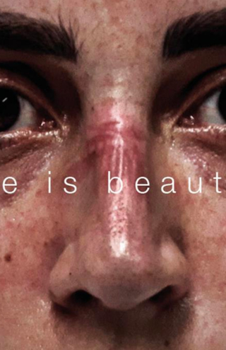 Campaign of the Day : Dove | Όταν ένα σαπούνι γίνεται σύμβολο κοινωνικής αλλαγής